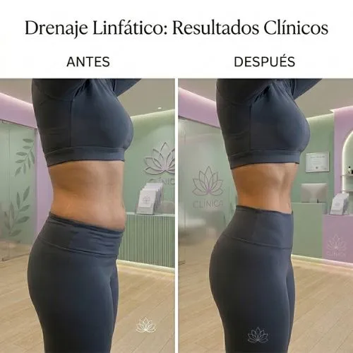 testimonio de rso de masaje de drenaje linfatico 6