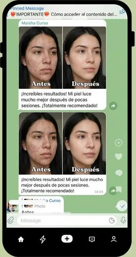 alunmos de rejuvenecimiento brasileno 4