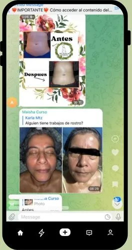 alunmos de rejuvenecimiento brasileno 5