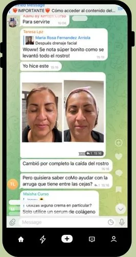 alunmos de rejuvenecimiento brasileno 6