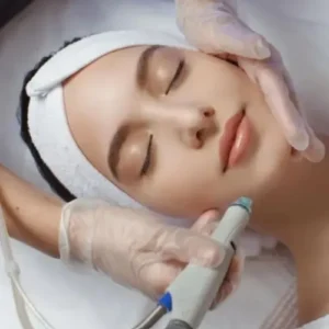 Microneedling