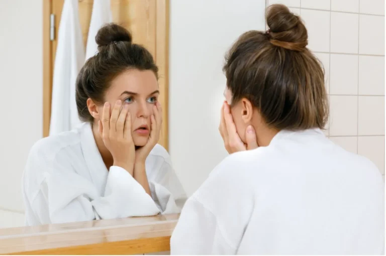 🌿(25) Enfermedades de la Piel Facial: Guía Completa para Reconocerlas y Tratarlas 7 🌿(25) Enfermedades de la Piel Facial: Guía Completa para Reconocerlas y Tratarlas
